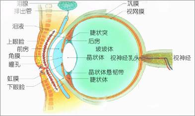 為什么會(huì)發(fā)展成高度近視？